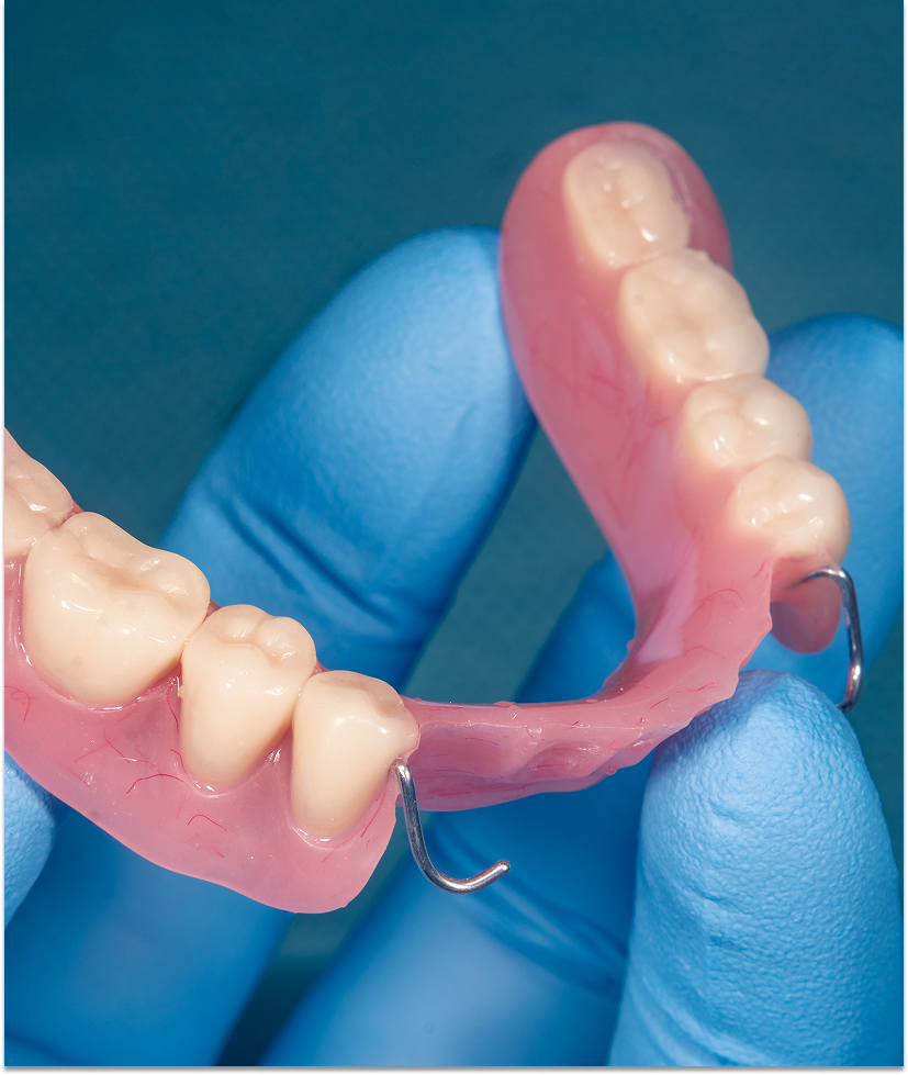 Les types de prothèses dentairesLes types de prothèses dentaires Les types de prothèses dentaires